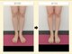 エステアンドトレーニング ビビ(ViVi)の写真/【美脚革命】筋膜リリースで血流を良くし、冷えや疲労を改善☆むくみスッキリ！スラっとした憧れの美脚へ
