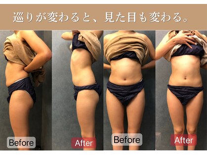 ロベリア(LoveliA)の写真