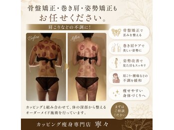 寧々/姿勢矯正 巻き肩