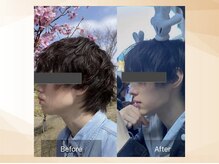 エモア メディカル整体院 恵比寿院(Emoa)/【20代男性】小顔矯正