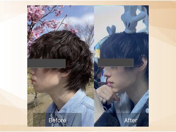 エモア メディカル整体院 恵比寿院(Emoa)/【20代男性】小顔矯正
