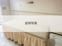 ハンナ(HanNa)/ハンドケア|フットケア|症例写真