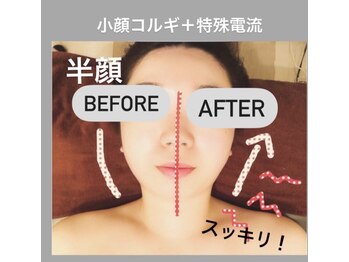 小顔骨気専門サロン パトラ(PATORA)/半額Before＆After