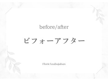 フロリール アザブジュウバン(FlorirAzabujuban)/3D小顔/造顔フェイシャル