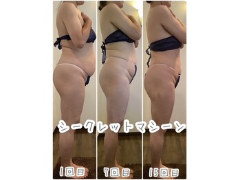 エステティックジュネス(JEUNESSE)