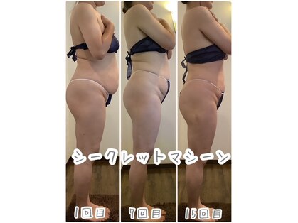 エステティックジュネス(JEUNESSE)の写真