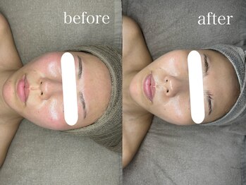 コム(comme39)/クリスティーナ×セルキュア