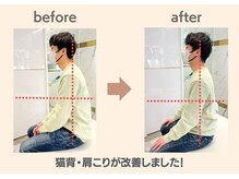 フィクシブ 上野(FIXIBE)/猫背が改善！