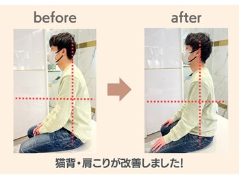 フィクシブ 上野(FIXIBE)/猫背が改善!
