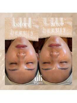 ウリ(uli beauty)/比較写真