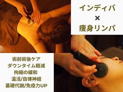 ランネル(Runnel)の写真