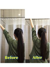 くすの樹接骨院 整体院 町田院/整体/骨盤矯正ビフォーアフター