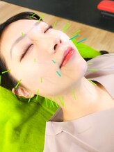 湘南Life鍼灸整体サロン 辻堂店/ライオン鍼-湘南life鍼灸整体