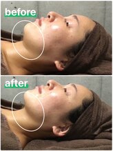 アネル 美里店(anel)/1回のフェイスラインの結果