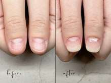 ユユネイル(yuyu nail)/深爪育成 自爪風仕上げ