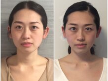 ウェリナ平和堂長久手院/小顔矯正/骨盤矯正/痩身/整体