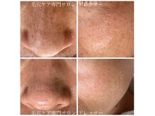 ドレッサー(Dresser)の雰囲気（戻ることのない悩み知らずの毛穴へ）