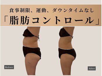 ナチュリ センター南院(NACHUL)/痩身エステ