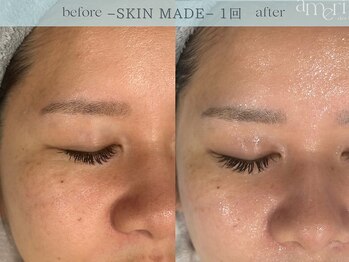 スキンラボアメリ(skin lab. ameri)/お悩み…毛穴 くすみ 乾燥