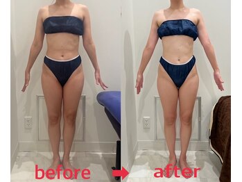 女神デトックス 名古屋金山店(女神DETOX)/【ビフォーアフター】