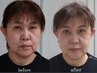 人気NO1【50代限定☆鏡を見るとため息をつく老化肌改善お試しコース】¥11000
