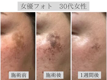 モンロー(MonroE+)/★女優フォト★