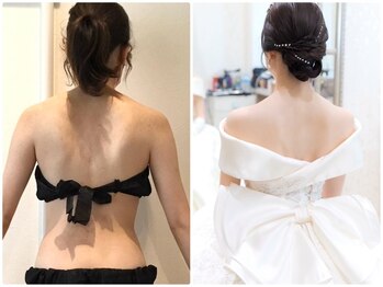 ラ・コンシェル 青葉台店(La Concier)の写真/ドレスから見える部分を集中ボディメイク【ブライダル痩身体験★¥3980】二の腕・肩甲骨を華奢な印象に♪