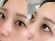 アニ 恵比寿(ani)の写真/約1.5ヶ月続く自分史上最高に可愛いまつ毛に☆