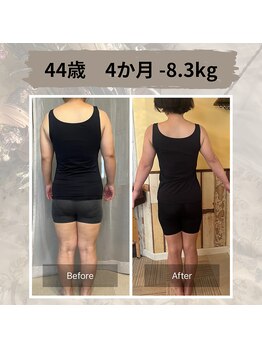 アネモネ/ダイエット/痩身/耳つぼ/腸活