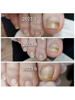 爪が伸び始めました