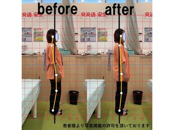 よし鍼灸接骨院 東花園院/施術効果【整体/骨盤矯正/大阪】