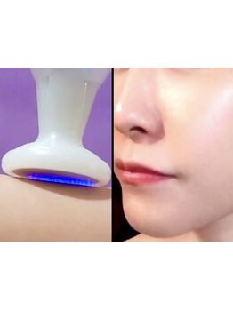 美白ケアをしたい