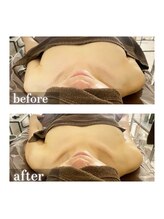 アンドボディ 横浜元町(&Body)/左右差改善/横浜元町