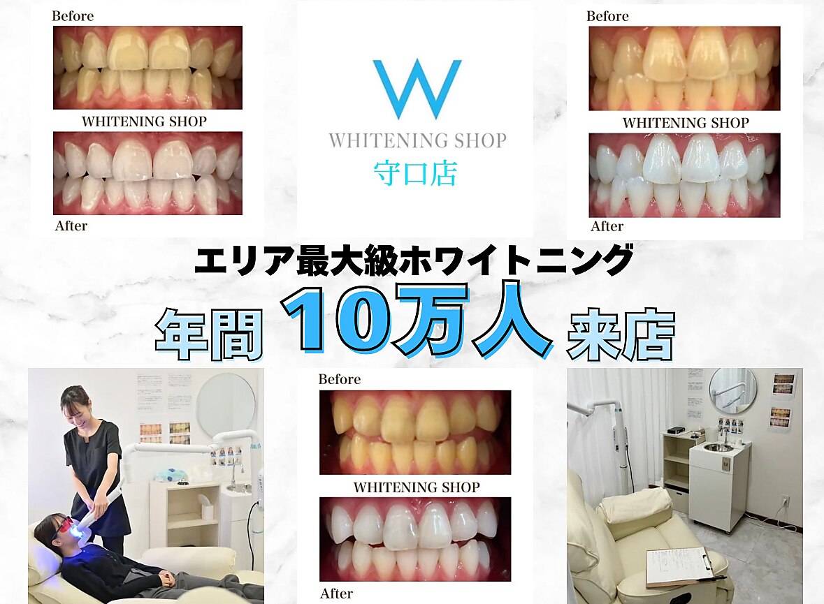 【医療提携】ホワイトニングメニュー導入　単品可 医療提携】ホワイトニングメニュー導入 単品可