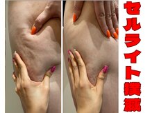 ブルーム(BL∞M)