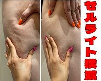 ブルーム(BL∞M)