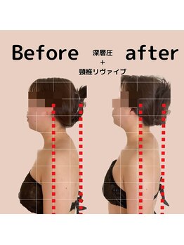 ユリラ(Yu'ReLa)の写真/首に特化した整体技術

首のストレッチで、ストレートネック・猫背・巻き肩を改善