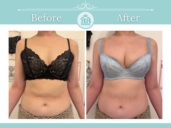 美人バスト 渋谷店/【バストアップ】お客様のお声♪