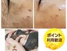 【シミ・シワ・たるみ毛穴集中改善】ハーブピーリング＋立体小顔90分
