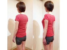 松山美容整体院/（30歳代）施術例