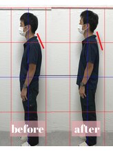 整体アンドボディメイク 禅/【ねこ背矯正】施術回数１回目