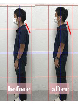 整体アンドボディメイク 禅/【ねこ背矯正】施術回数１回目