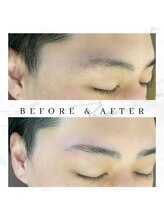 アート(ART)/ハリウッドブロウリフト