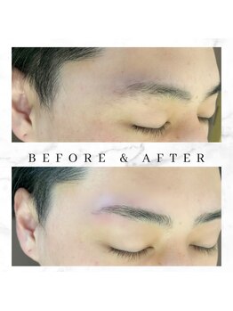 アート(ART)/ハリウッドブロウリフト