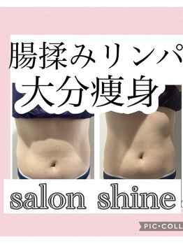 サロンシャイン(Salon Shine)/ハンド＆ラジオ波＆超音波４０代
