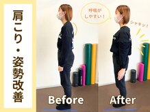 ゲンキ鍼灸整骨院 高槻(Genki鍼灸整骨院)/肩こり・姿勢改善の変化