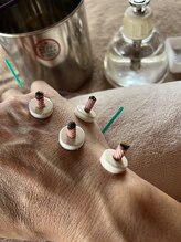 ライズ/手への施術