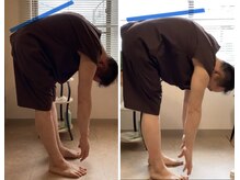 エクステンド鍼灸整体院(extend鍼灸整体院)/施術後　鍼・指圧