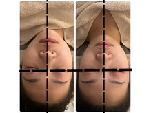 エマーチェ 自由が丘(emmace)の雰囲気（骨格から整え、左右差のないシンメトリー小顔へ♪）