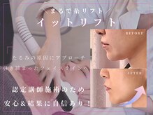 アールスタイルビューティ(R STYLE BEAUTY)の雰囲気（肌の内側からリフトアップし、フェイスラインを引き締めます！）